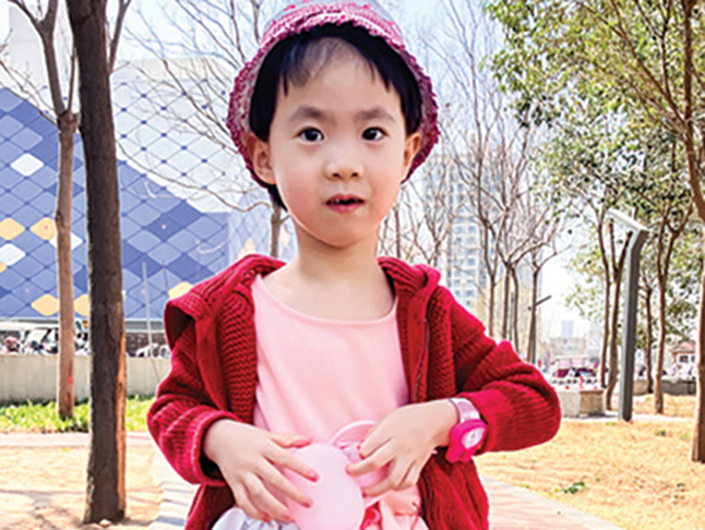 young chinese girl with cleft lip and palate, repaired